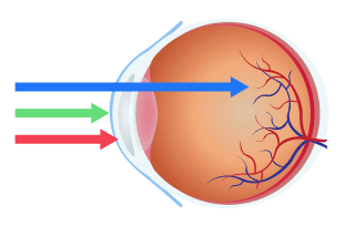 Lens scheme